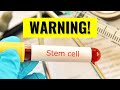 Stem Cell Therapies for Osteoarthritis