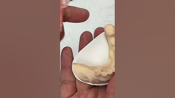 Difficult double arch partial case because the tight bite @EnvisiontecMain #envisiontec