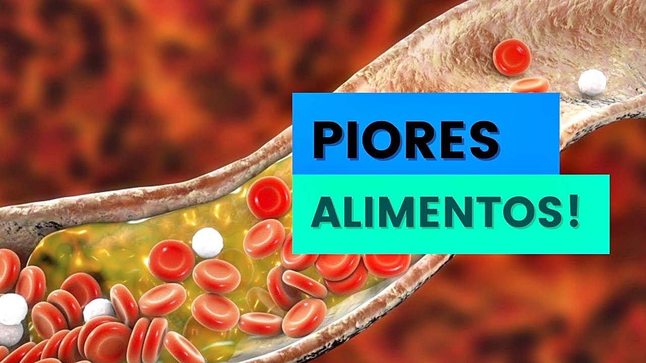 COLESTEROL ALTO? Pare de comer esses alimentos! - YouTube