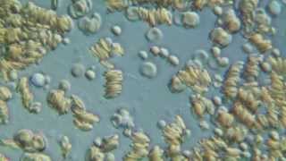 Human Blood Cells Under The Microscope In 1080P Hd