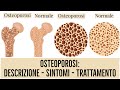 OSTEOPOROSI: Come degenera l’apparato scheletrico