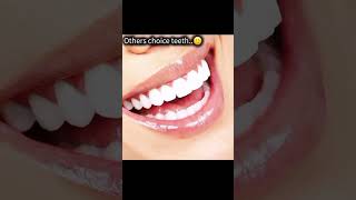 Others choice Vs my choice ⚡. ###monster ##teeth ###devil ##shorts