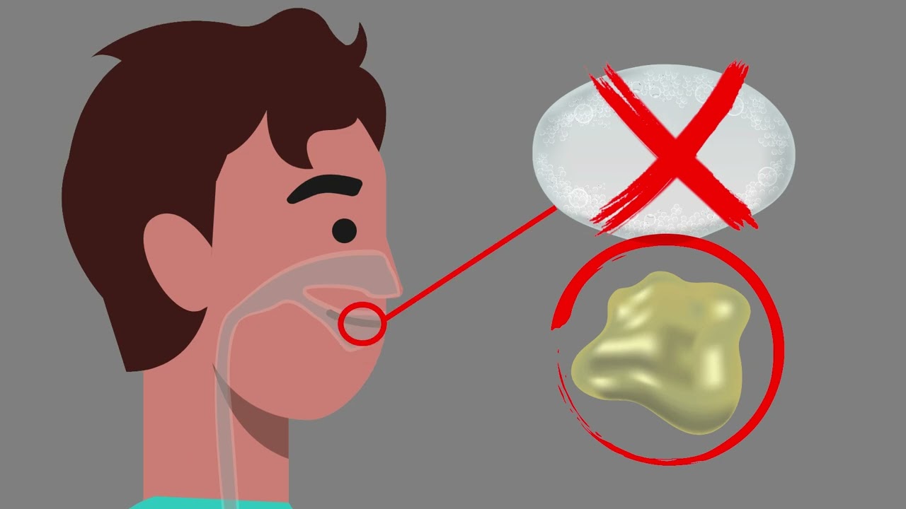 Recolección de esputo en el hogar (Home Sputum Collection - Spanish version)