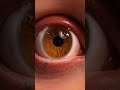 How Eye Infections Are Treated | Inside the Eye's Healing Process