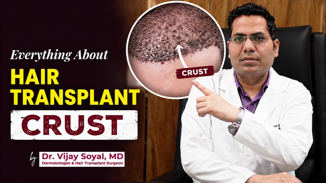 Hair Loss Treatment Journey — Dr Vijay Soyal Skinfollix