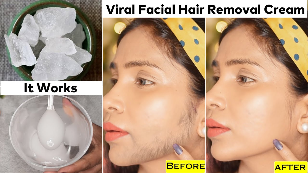 How I Permanently Reduce My Facial Hair in 4 Weeks-NO Shaving & Waxing-100% Natural-Hair Removal Gel
