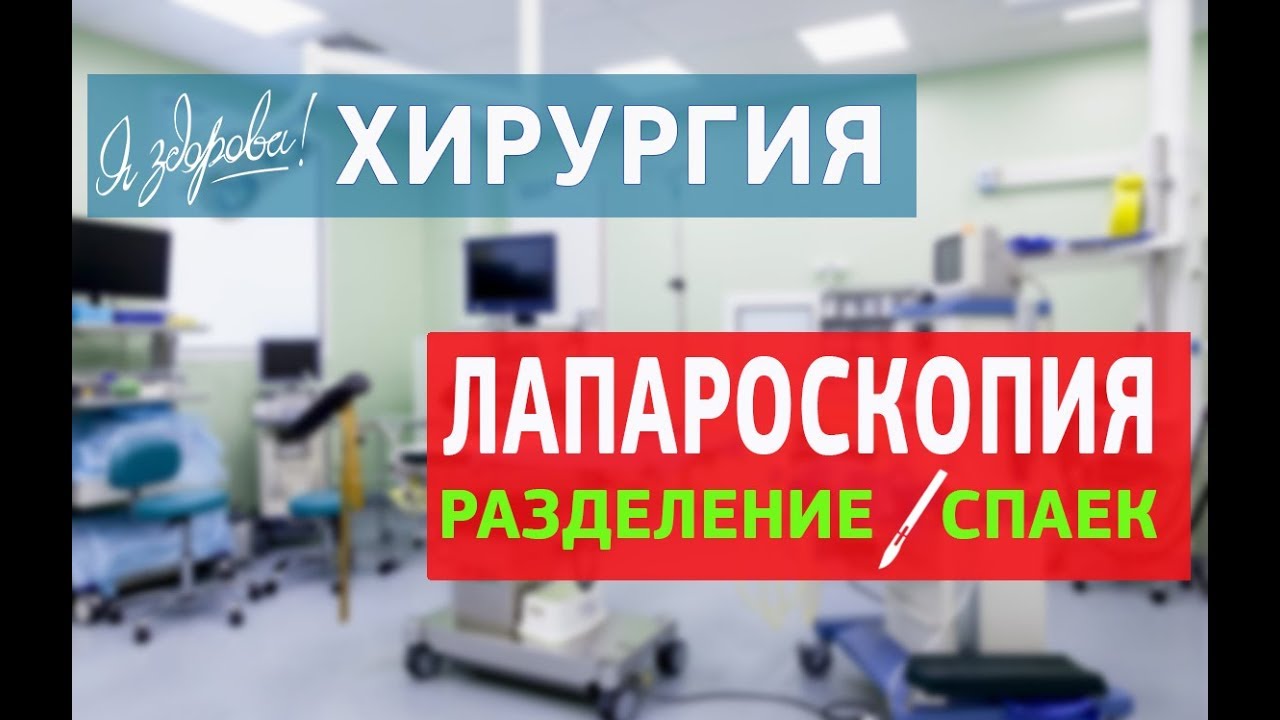 Лапароскопия. Разделение спаек