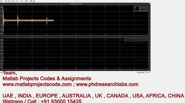 Sensorless Field Oriented Control (FOC) Induction motor drive || FOC || Smart Electric Vehicle