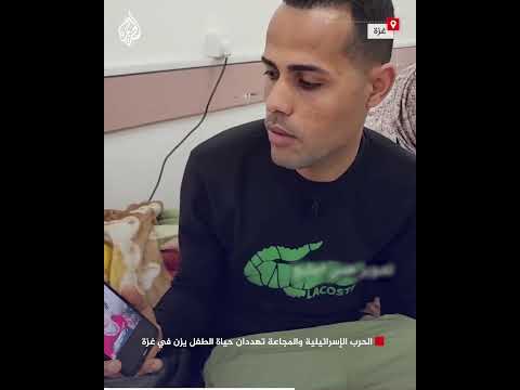 الحرب الإسرائيلية والمجاعة تهددان حياة الطفل يزن في غزة