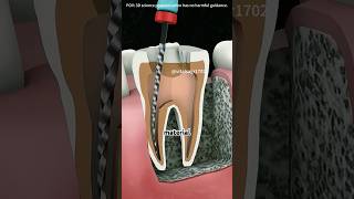 Root Canal Treatment (3D Animation)#teeth #facts #doctor #science #hospital #toothdevelopment