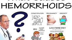 What causes hemorrhoids?