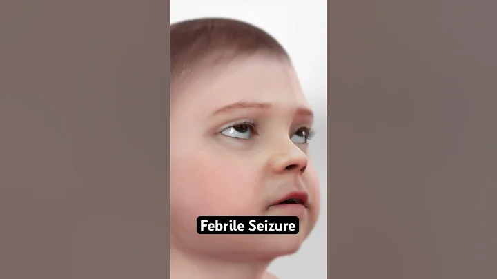 Febrile Seizure (3D Animation)