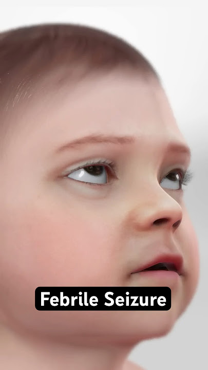Febrile Seizure (3D Animation)