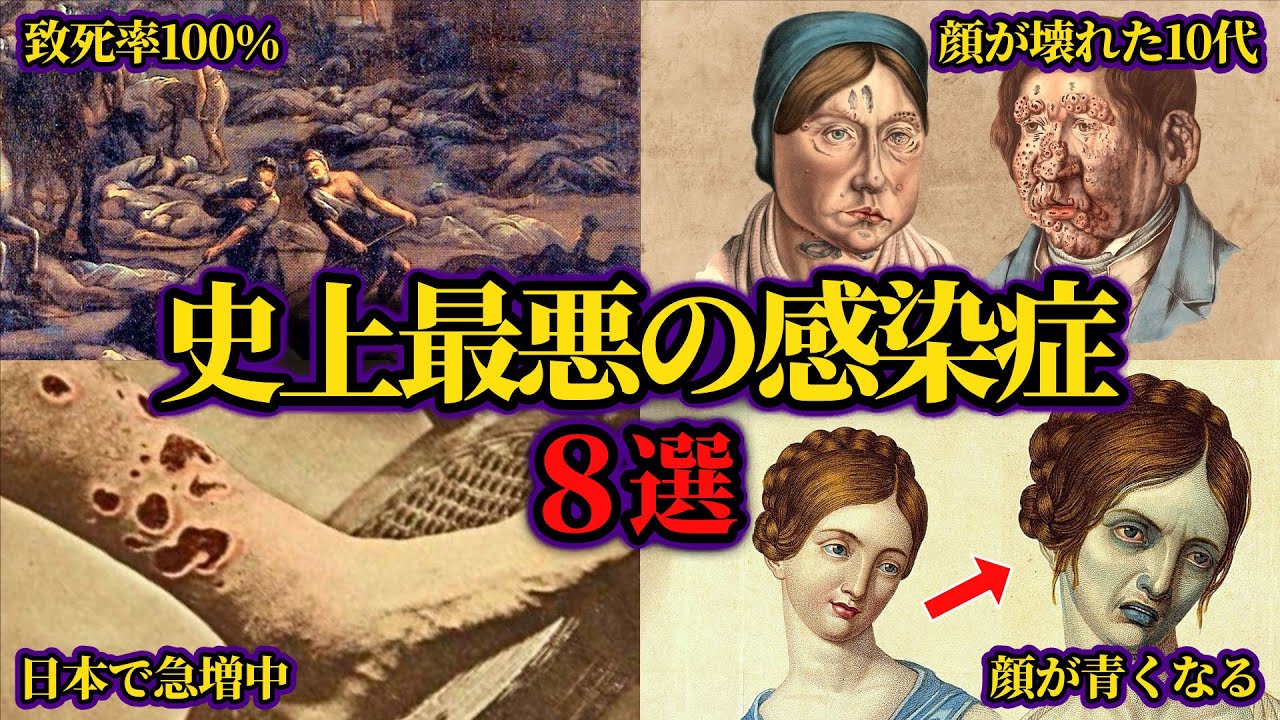 【総集編】世界が絶望した最悪の感染症の歴史【ゆっくり歴史解説】