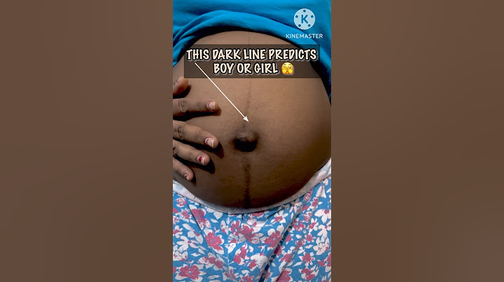 Pregnancy dark line on belly II Linea Nigra II #viral #shorts #youtubeshorts #pregnancy