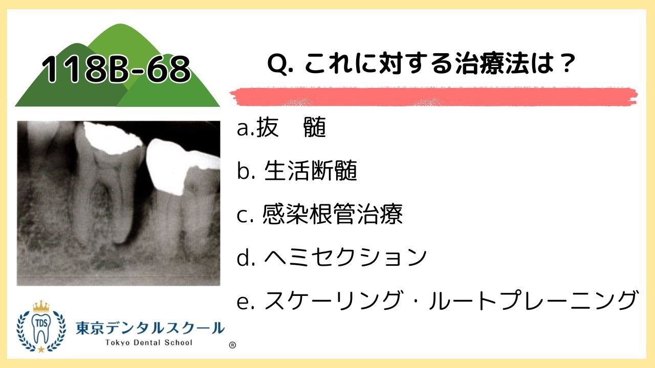 歯内・歯周・補綴治療の臨床判断。「こんなときどうする？」を解決するヒント26 極美品】歯内・歯周・補綴治療の臨床判断 : 「こんなとき