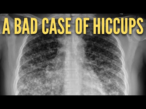 An Interesting But Unfortunate Medical Case