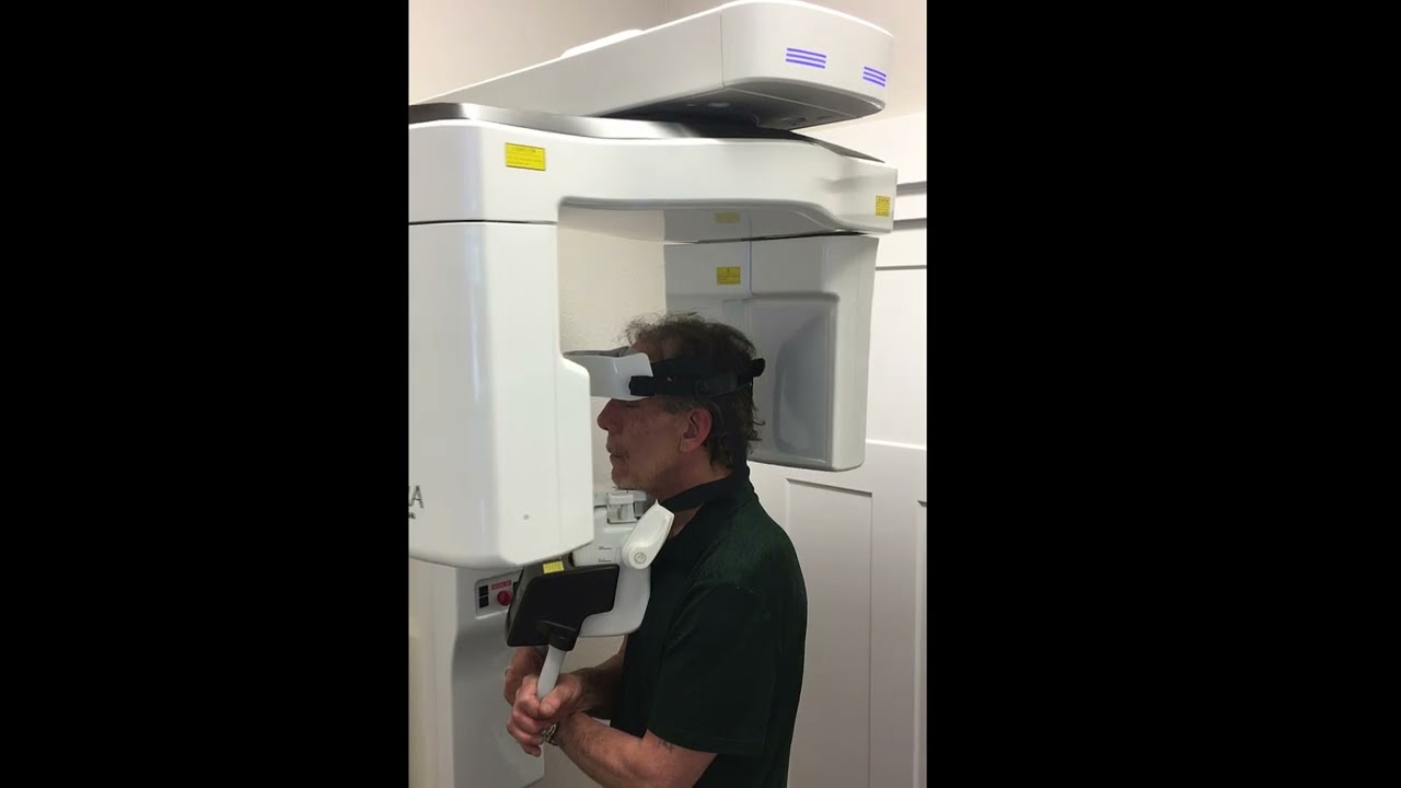 Panoura X-era Dental Cone Beam Machine HD Scan Video