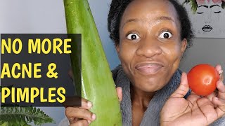I used FRESH ALOE VERA & tomatoe on my face for 5days/REAL RESULTS