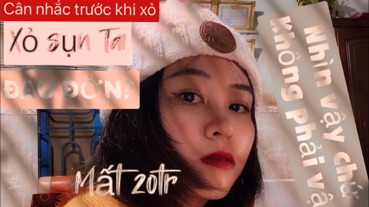 CÁC LƯU Ý KHI XỎ KHUYÊN SỤN TAI! | Tổng quát các tài liệu liên quan đến bấm lỗ tai trên sụn đầy đủ nhất