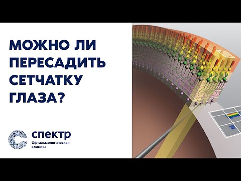 Секреты сетчатки: Почему это важно и как сохранить зрение на всю жизнь.