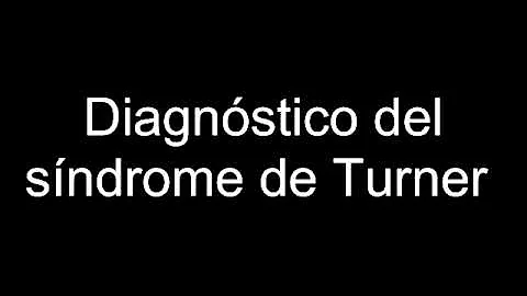 O que causa a síndrome de Turner?