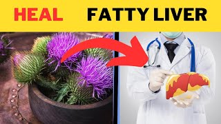 5 Must-Have Supplements for Fatty Liver | Boost Liver Health Today! #FattyLiver #LiverHealth