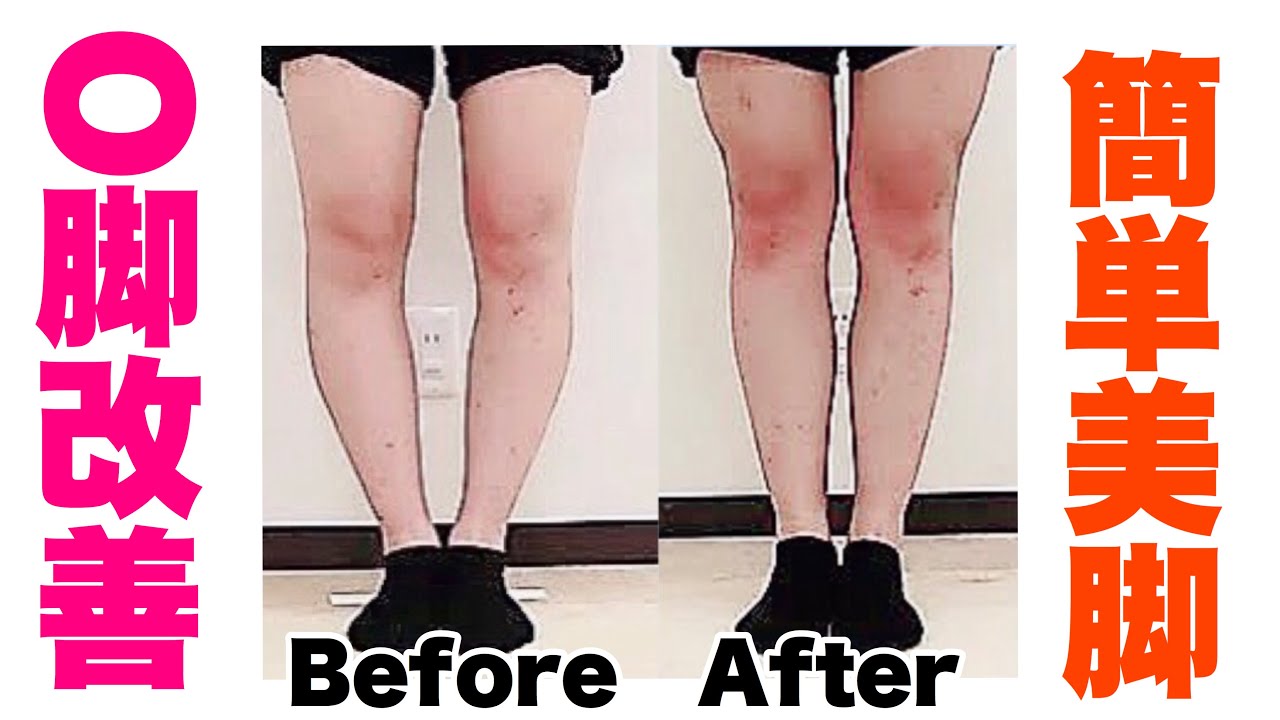 O脚改善 筋トレ 簡単筋トレで美脚になる 骨盤矯正 内ももトレ Youtube