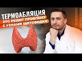 ТЕРМОАБЛЯЦИЯ – решение для УЗЛОВ щитовидной железы