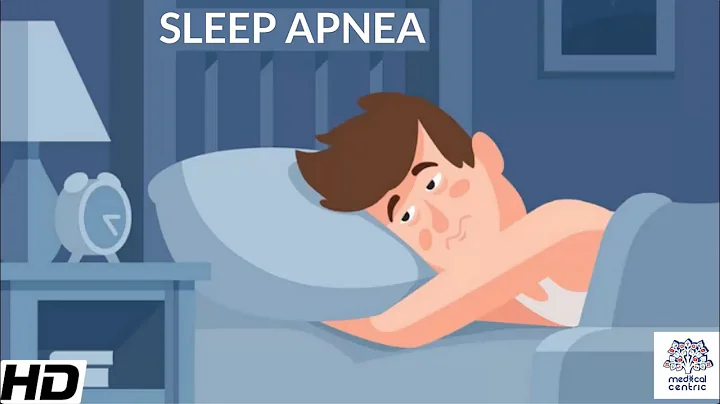 Sleep Apnea, Causes,Signs and Symptoms, DIagnosis and Treatment.