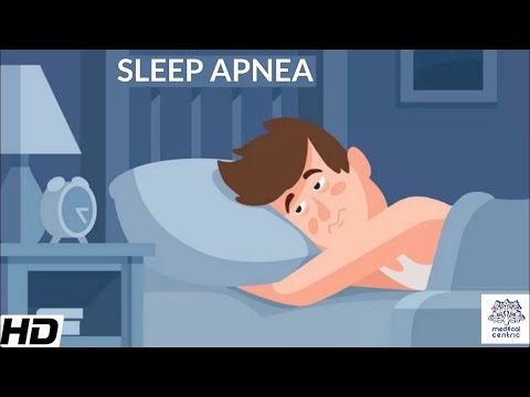 Video: 4 způsoby, jak rozpoznat příznaky spánkové apnoe