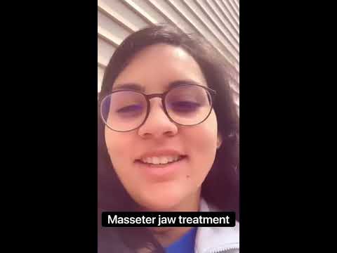Masseter/Jaw Botox (Dysport, Xeomin) to Treat TMJ 