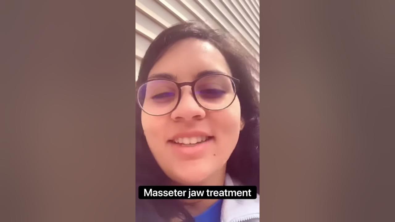 Masseter/Jaw Botox (Dysport, Xeomin) to Treat TMJ 