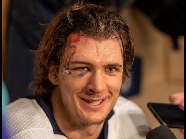 Winnipeg Jets Player Returns to Game After Taking Skate to Face