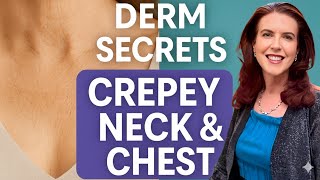 How to FIX a Crepey Neck and Chest-What REALLY Works!