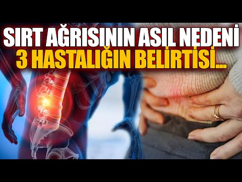 Sırt Ağrısının Asıl Nedeni 3 Hastalığın Belirtisi...