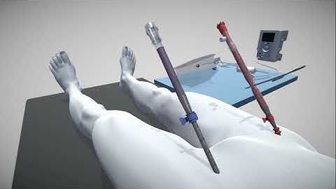 TandemLife Animation