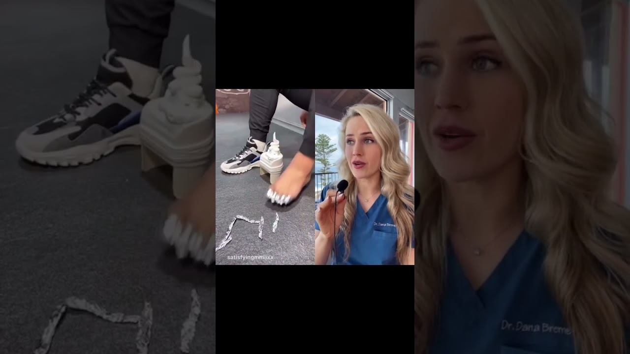 Doctor reacts to bizarre foot TikTok