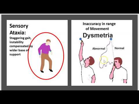 Vidéo: Quelle est la différence entre l'ataxie et la dysmétrie?