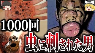 【ゆっくり解説】歪んでる…あえて1000回虫に刺されてみた男
