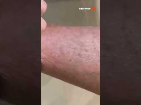 Bolsonaro admite ter violado tornozeleira; “meti um ferro quente aqui”