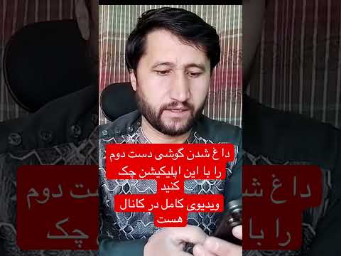 داغ شدن گوشی های دست دوم یک مشکل این گوشی ها است حتما چک کنید   