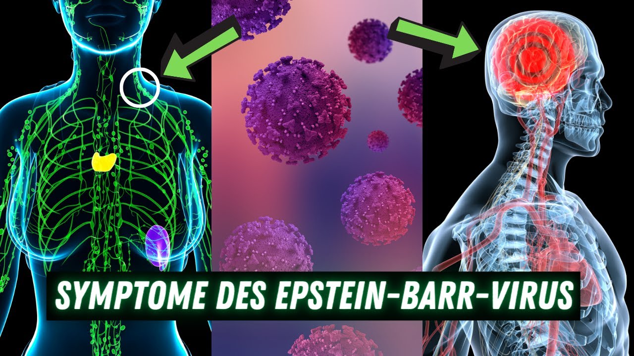 Epstein Barr Virus Reaktivierung Symptome www.youtube.com