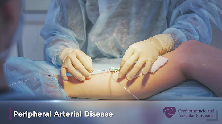 Limb Preservation and Amputation Prevention | Peripheral Arterial Disease | CTVS Texas