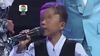 Kasihan anak Ini tidak punya mata Tapi pandai menyanyi sedih 😩😭😭