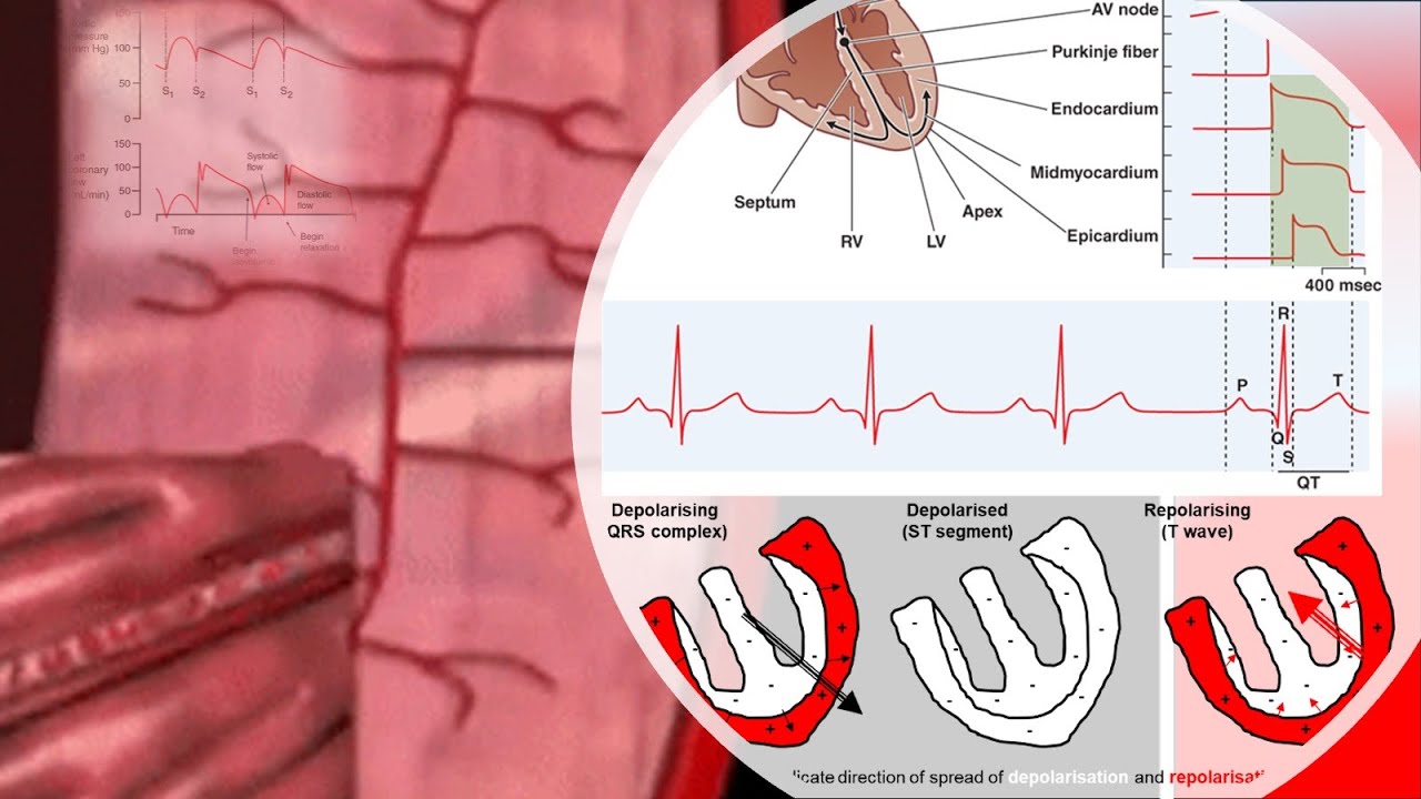 Cardiac & ECG Physiology | T Wave Shape – Understanding Ventricular Repolarisation