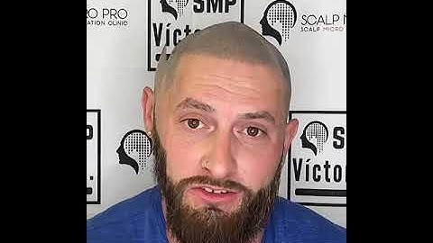 Scalp Micro Pigmentation! Best and Undetectable Amazing Results! @smp.victore