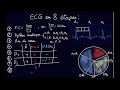 ECG en 8 étapes - Docteur Synapse