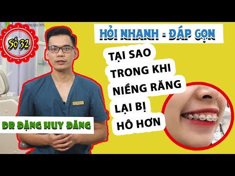 Video GIẢI THÍCH TẠI SAO NIỀNG RĂNG LẠI BỊ HÔ RA - youtube