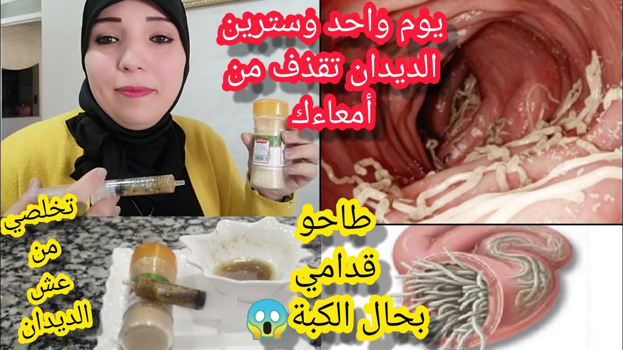 يخليوك بلا صحة/دفعة واحدة من هذا المكون وغادي تشوفي عش الديدان بعينيك غادي تهناي من الدودة الشريطية🤔